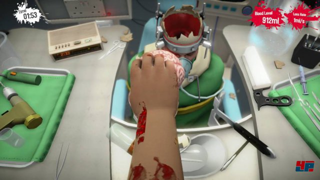 Screenshot - Surgeon Simulator 2013 (PlayStation4) 92489271