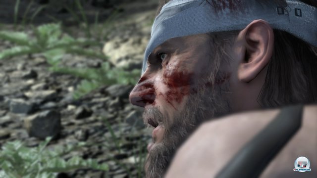 Screenshot - Metal Gear Solid V: The Phantom Pain (360) 92458189