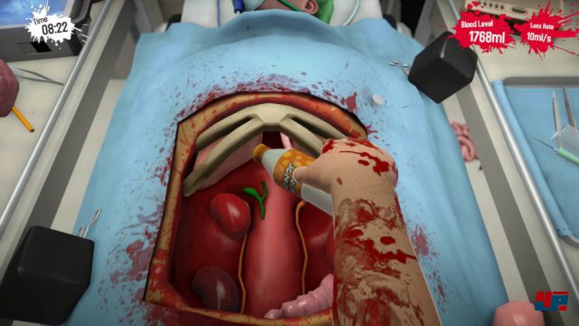Screenshot - Surgeon Simulator 2013 (PlayStation4) 92489270